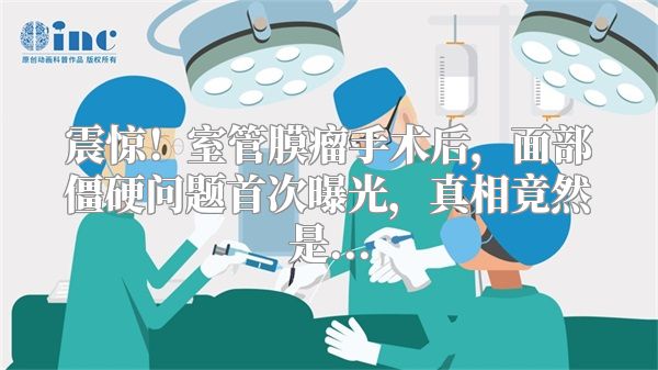 震惊！室管膜瘤手术后，面部僵硬问题首次曝光，真相竟然是...