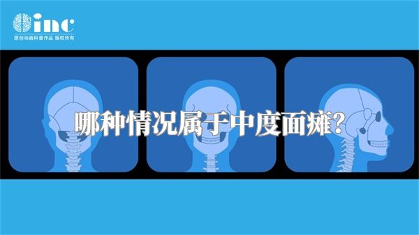 哪种情况属于中度面瘫？