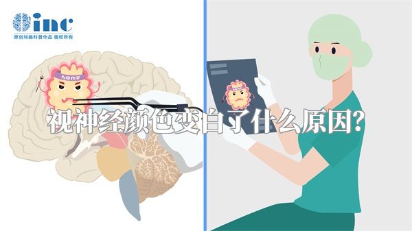 视神经颜色变白了什么原因？