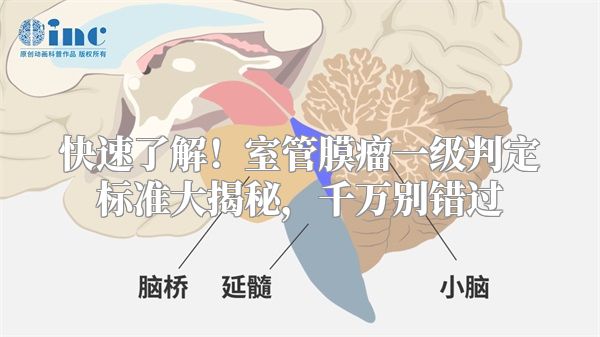 快速了解！室管膜瘤一级判定标准大揭秘，千万别错过