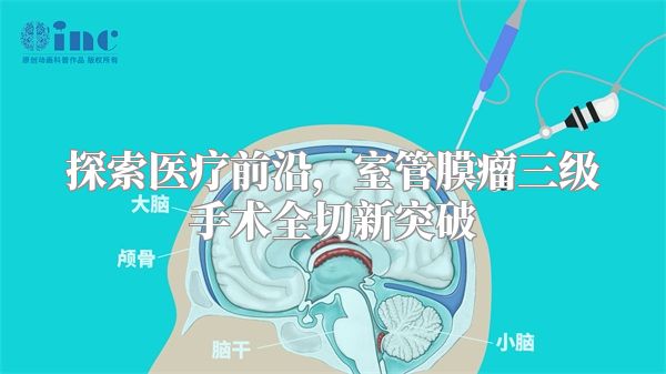 探索医疗前沿，室管膜瘤三级手术全切新突破