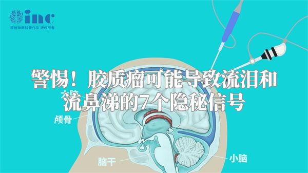 警惕！胶质瘤可能导致流泪和流鼻涕的7个隐秘信号