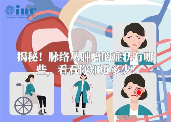 揭秘！脉络丛肿瘤的症状有哪些，看看你知道多少！