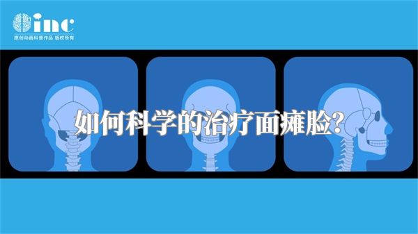 如何科学的治疗面瘫脸？