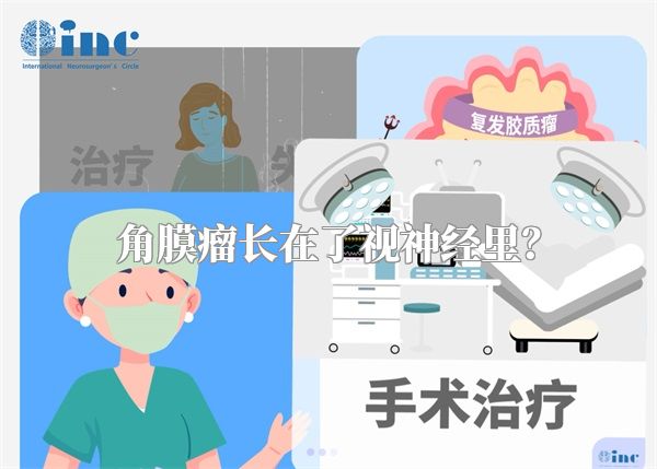 角膜瘤长在了视神经里?