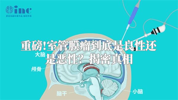 重磅!室管膜瘤到底是良性还是恶性？揭密真相