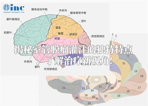 揭秘室管膜瘤灌注的独特特点，了解治疗新视角!