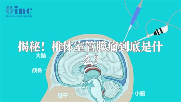 揭秘！椎体室管膜瘤到底是什么？
