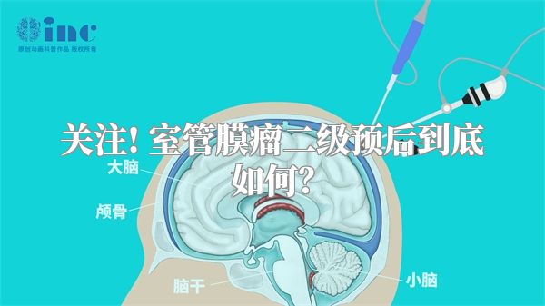 关注! 室管膜瘤二级预后到底如何？