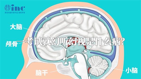 一考试就幻听幻视是什么病？