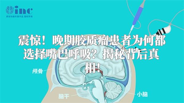 震惊！晚期胶质瘤患者为何都选择嘴巴呼吸？揭秘背后真相！