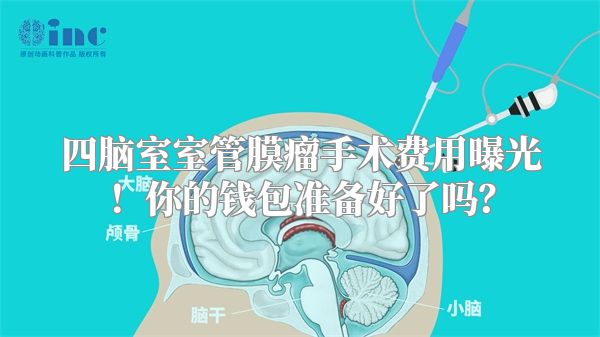 四脑室室管膜瘤手术费用曝光！你的钱包准备好了吗？