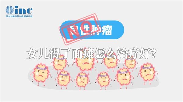 女儿得了面瘫怎么治疗好？
