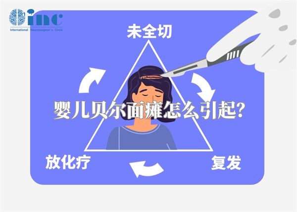 婴儿贝尔面瘫怎么引起？