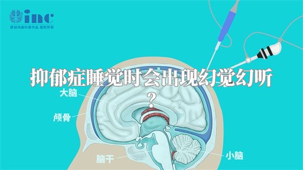抑郁症睡觉时会出现幻觉幻听？