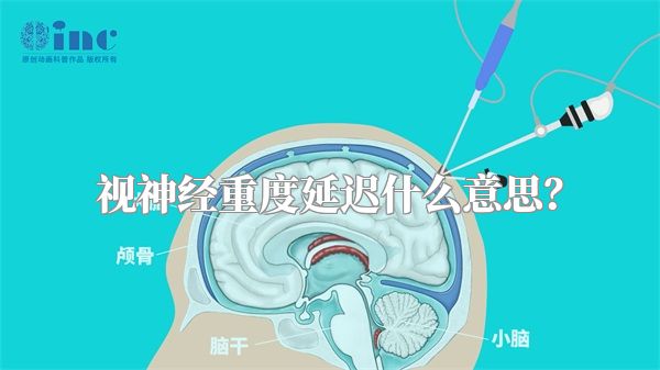 视神经重度延迟什么意思?