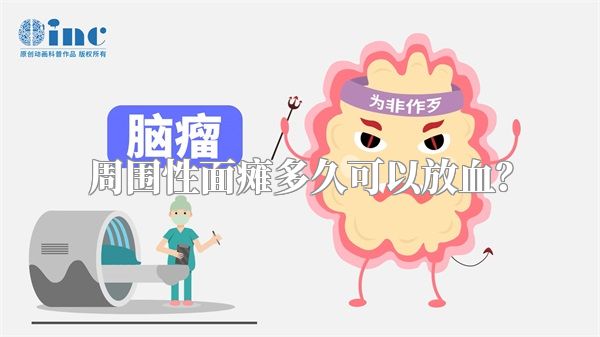 周围性面瘫多久可以放血？