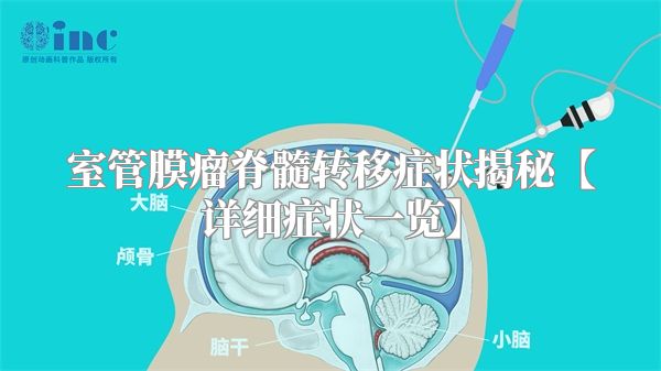 室管膜瘤脊髓转移症状揭秘【详细症状一览】
