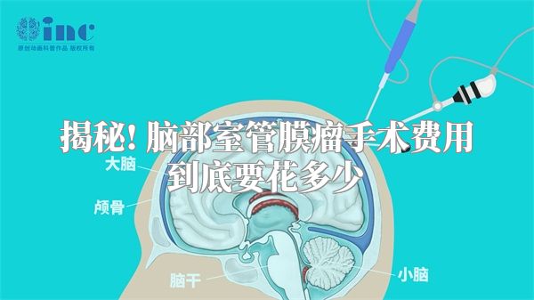 揭秘! 脑部室管膜瘤手术费用到底要花多少
