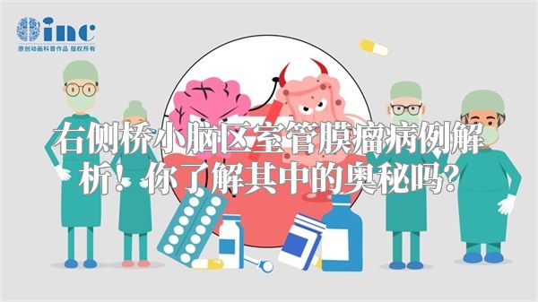 右侧桥小脑区室管膜瘤病例解析！你了解其中的奥秘吗？