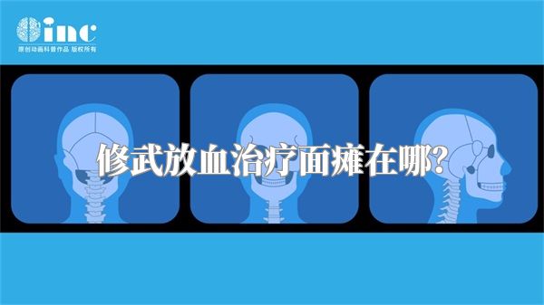 修武放血治疗面瘫在哪？