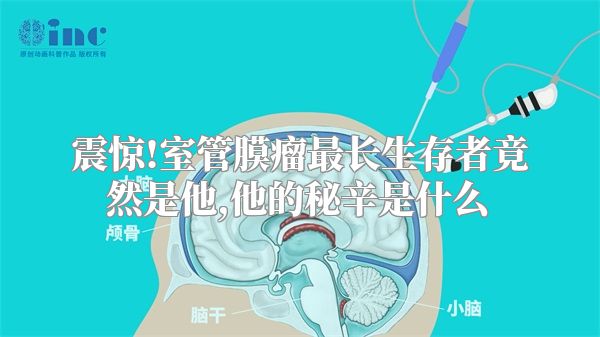 震惊!室管膜瘤最长生存者竟然是他,他的秘辛是什么