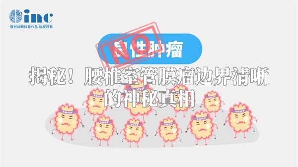 揭秘！腰椎室管膜瘤边界清晰的神秘真相