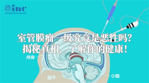 室管膜瘤一级究竟是恶性吗？揭秘真相，了解你的健康！