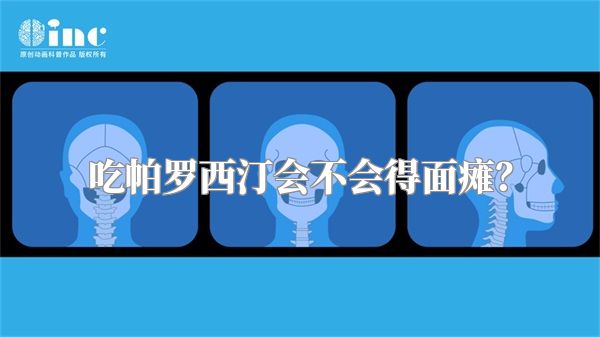 吃帕罗西汀会不会得面瘫？