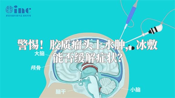 警惕！胶质瘤头上水肿，冰敷能否缓解症状？