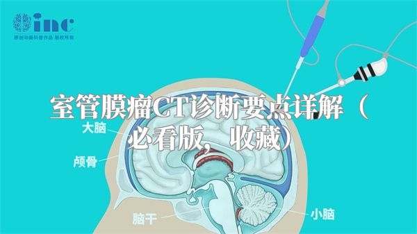 室管膜瘤CT诊断要点详解（必看版，收藏）
