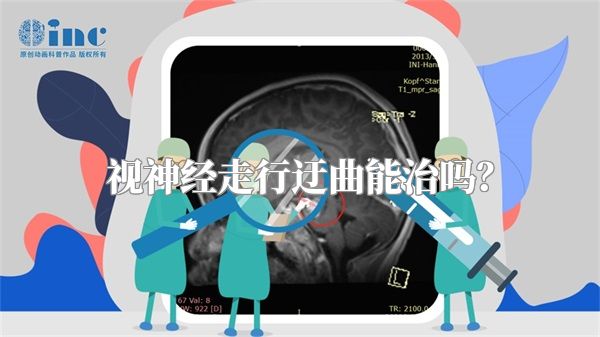 视神经走行迂曲能治吗?