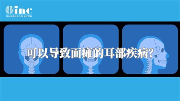 可以导致面瘫的耳部疾病？