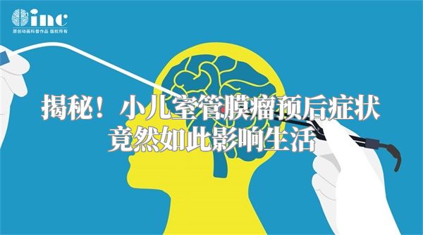 揭秘！小儿室管膜瘤预后症状竟然如此影响生活