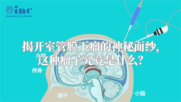 揭开室管膜下瘤的神秘面纱，这种瘤子究竟是什么？