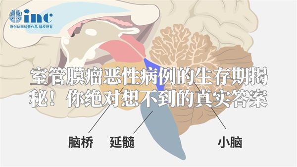 室管膜瘤恶性病例的生存期揭秘！你绝对想不到的真实答案