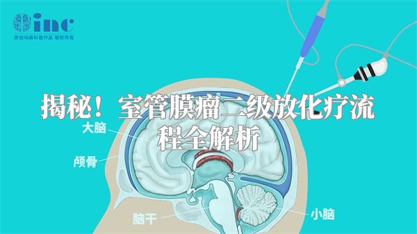 揭秘！室管膜瘤二级放化疗流程全解析