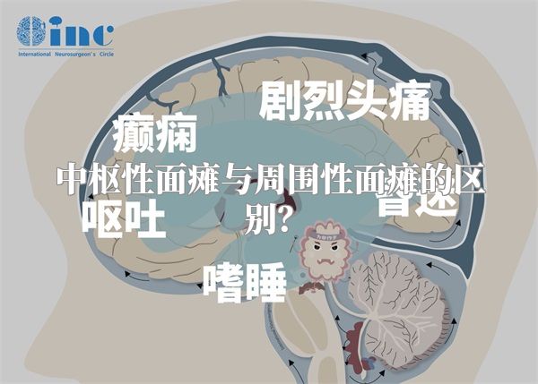 中枢性面瘫与周围性面瘫的区别？