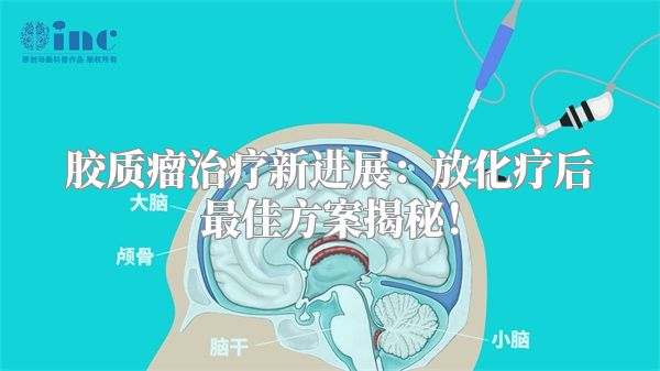 胶质瘤治疗新进展：放化疗后最佳方案揭秘！