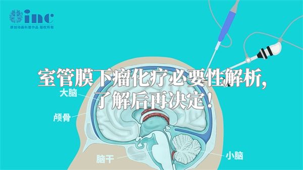 室管膜下瘤化疗必要性解析，了解后再决定！