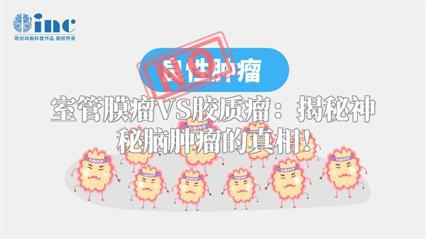 室管膜瘤VS胶质瘤：揭秘神秘脑肿瘤的真相！