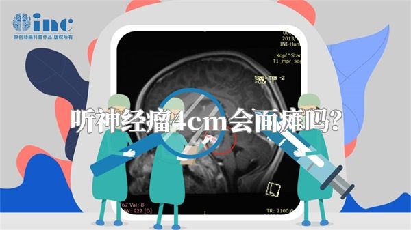 听神经瘤4cm会面瘫吗？