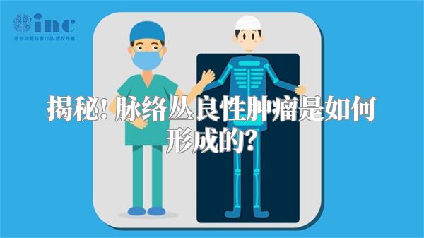 揭秘! 脉络丛良性肿瘤是如何形成的？