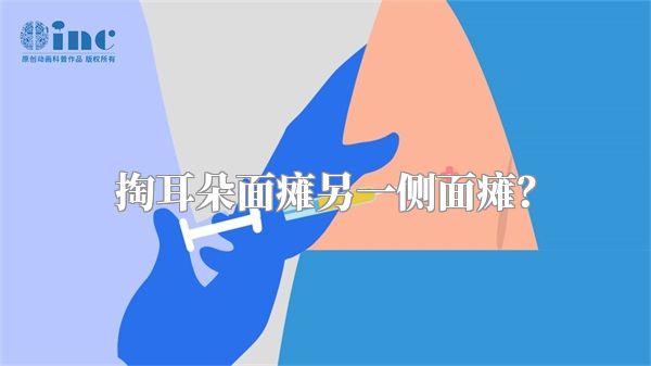 掏耳朵面瘫另一侧面瘫？