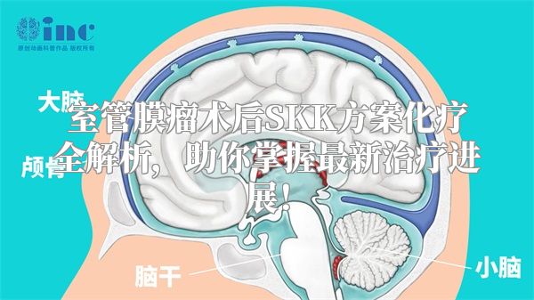 室管膜瘤术后SKK方案化疗全解析，助你掌握最新治疗进展！