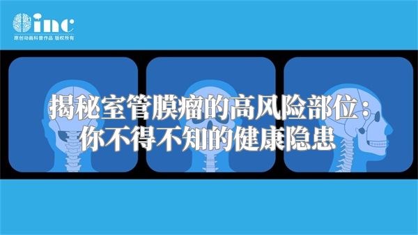 揭秘室管膜瘤的高风险部位：你不得不知的健康隐患