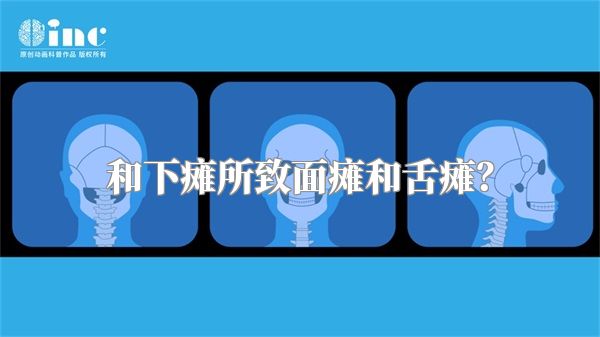和下瘫所致面瘫和舌瘫？