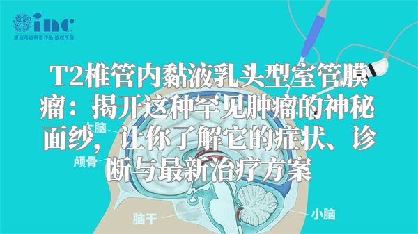 T2椎管内黏液乳头型室管膜瘤：揭开这种罕见肿瘤的神秘面纱，让你了解它的症状、诊断与最新治疗方案