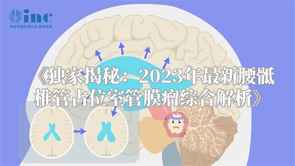 《独家揭秘：2023年最新腰骶椎管占位室管膜瘤综合解析》
