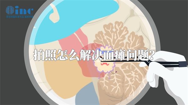 拍照怎么解决面瘫问题？